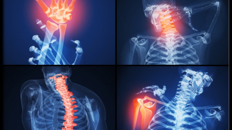 könyökízület fájdalmának kezelése a térd medialis meniszkuszának trauma